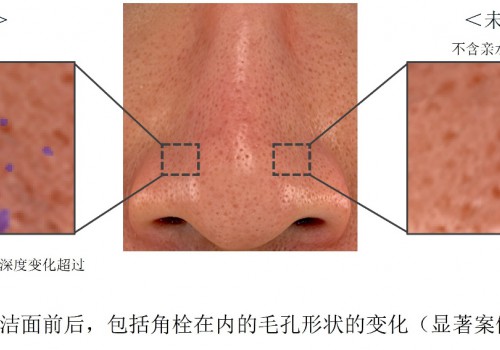 花王开发全新皮肤清洁技术 以亲水微米级粉体配合基于氨丁三醇的“角栓崩解清洁技术”